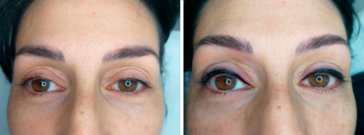 eyeline_03