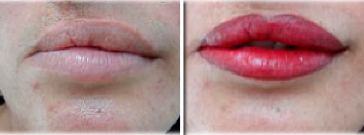 lips_01