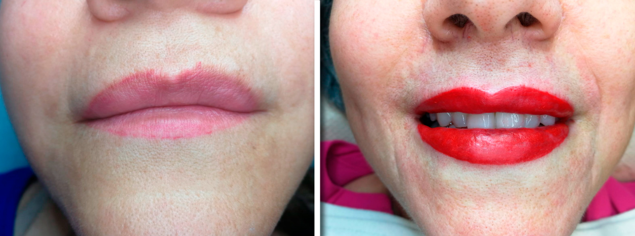 lips_02