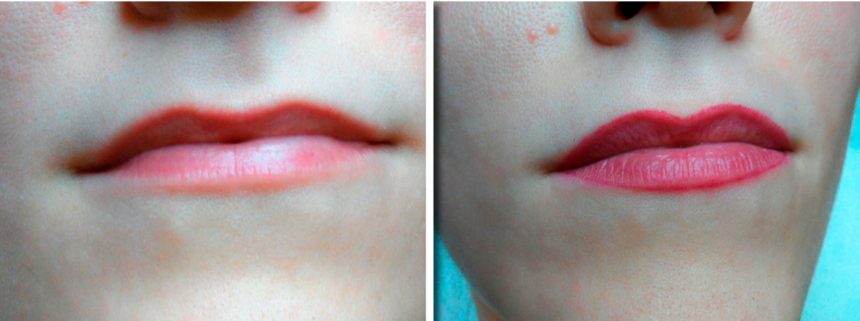 lips_03